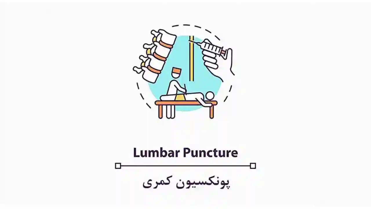 پونکسیون کمری یا Lumbar Puncture