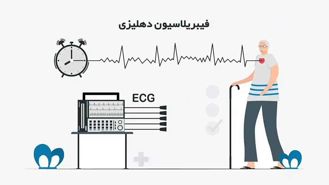 فیبریلاسیون دهلیزی (Atrial fibrillation) چیست؟ - نبض هوشمند سلامت